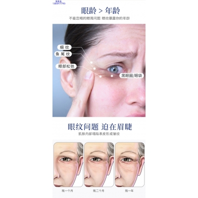 江西_美容院玻尿酸微针眼贴